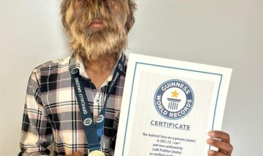 कभी चिढाते थे, आज साथ फोटो लेते है, वोल्फ मेन से प्रसिद्ध, ललित का नाम गिनीज बुक ऑफ वर्ल्ड रिकॉर्ड में दर्ज